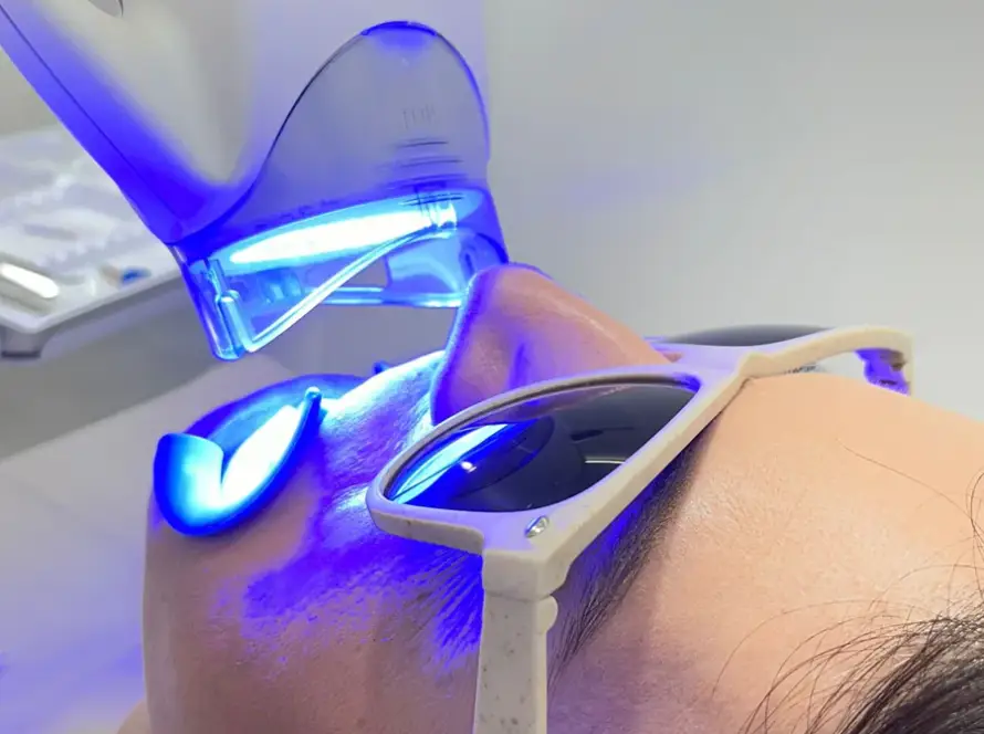 Procedimiento de luz ultravioleta en blanqueamiento dental