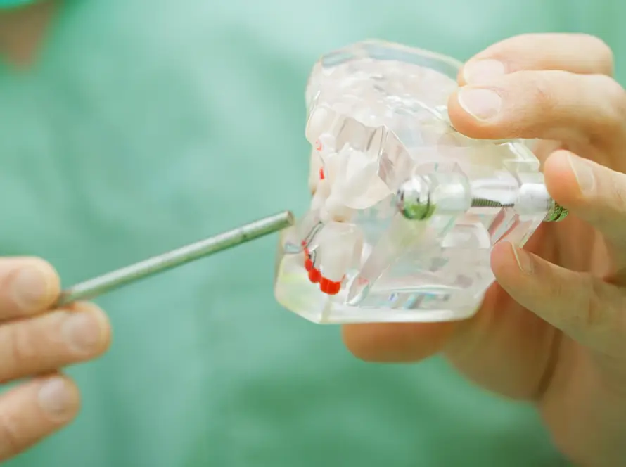 Molde de boca y dientes